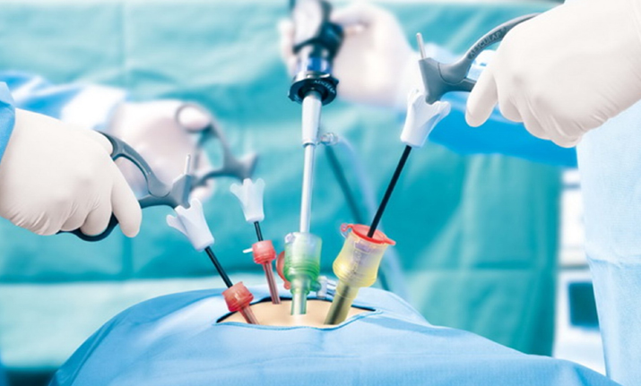 Laparoscopic-Surgery